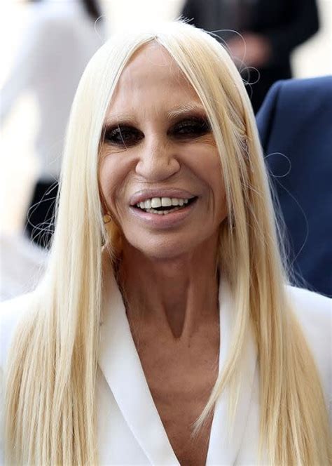 donatella versace botox|donatella versace face what happened.